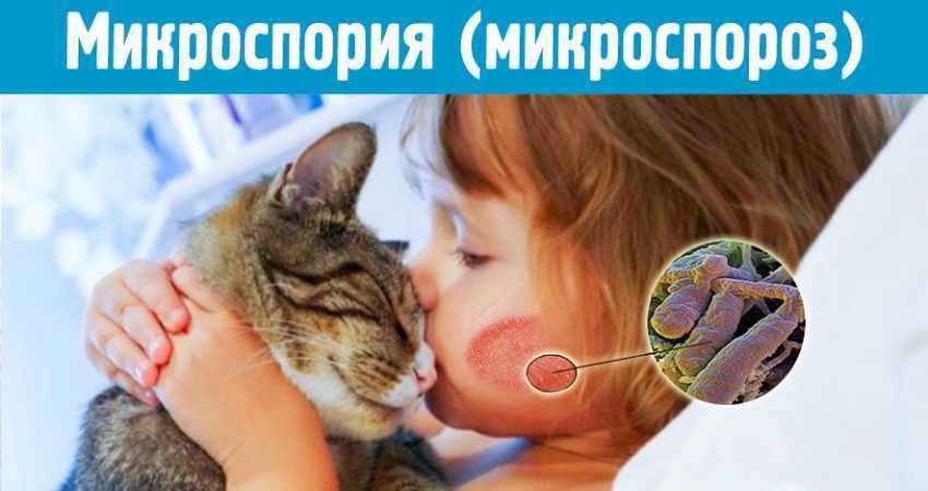 ВНИМАНИЕ! Микроспория!